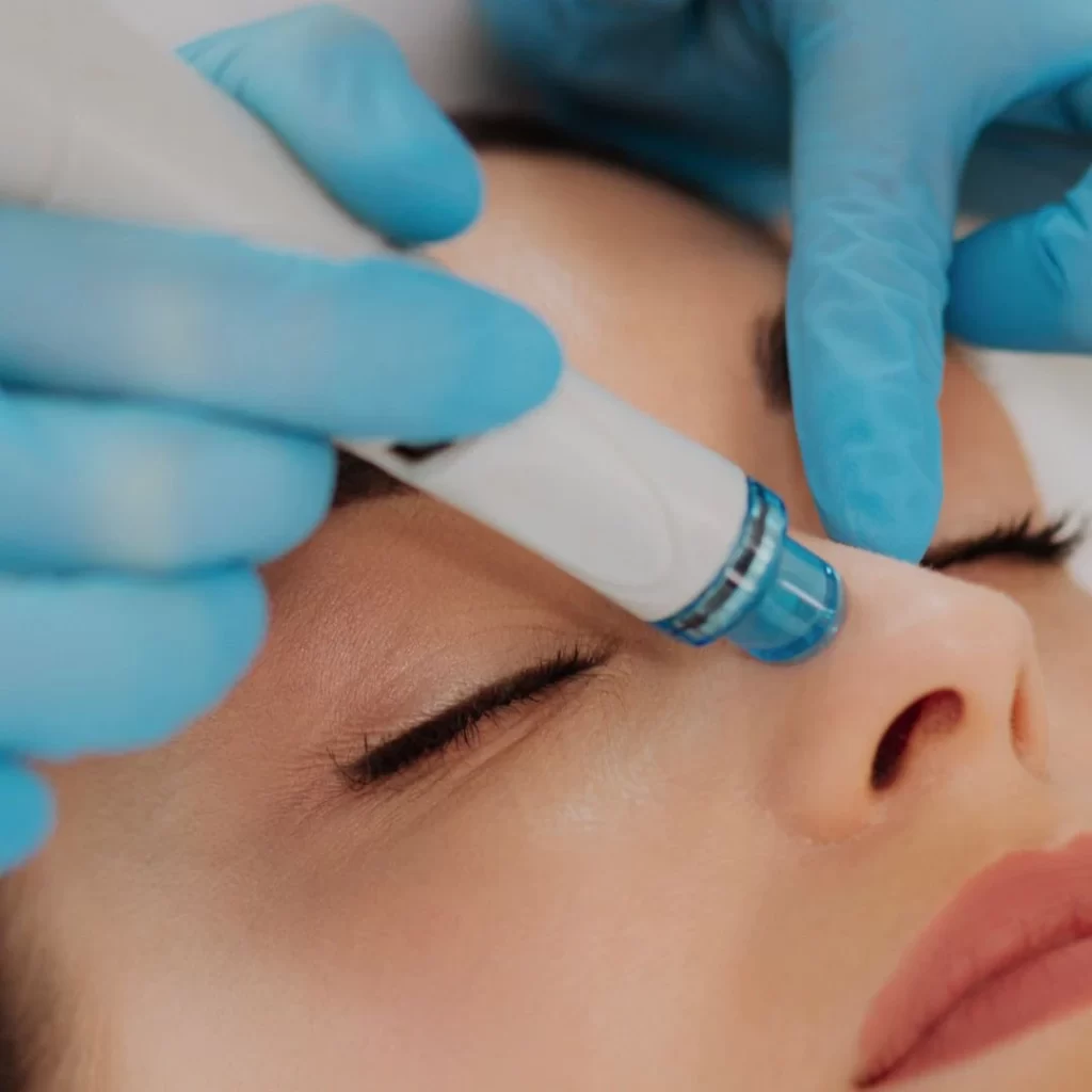 Tailored Hydrafacials in Fort Collins, CO