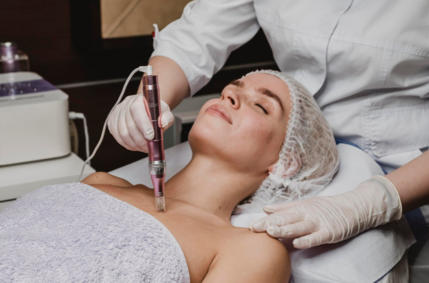 RF Microneedling